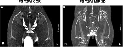 Assessment of Rat Sciatic Nerve Using Diffusion-Tensor Imaging With Readout-Segmented Echo Planar Imaging